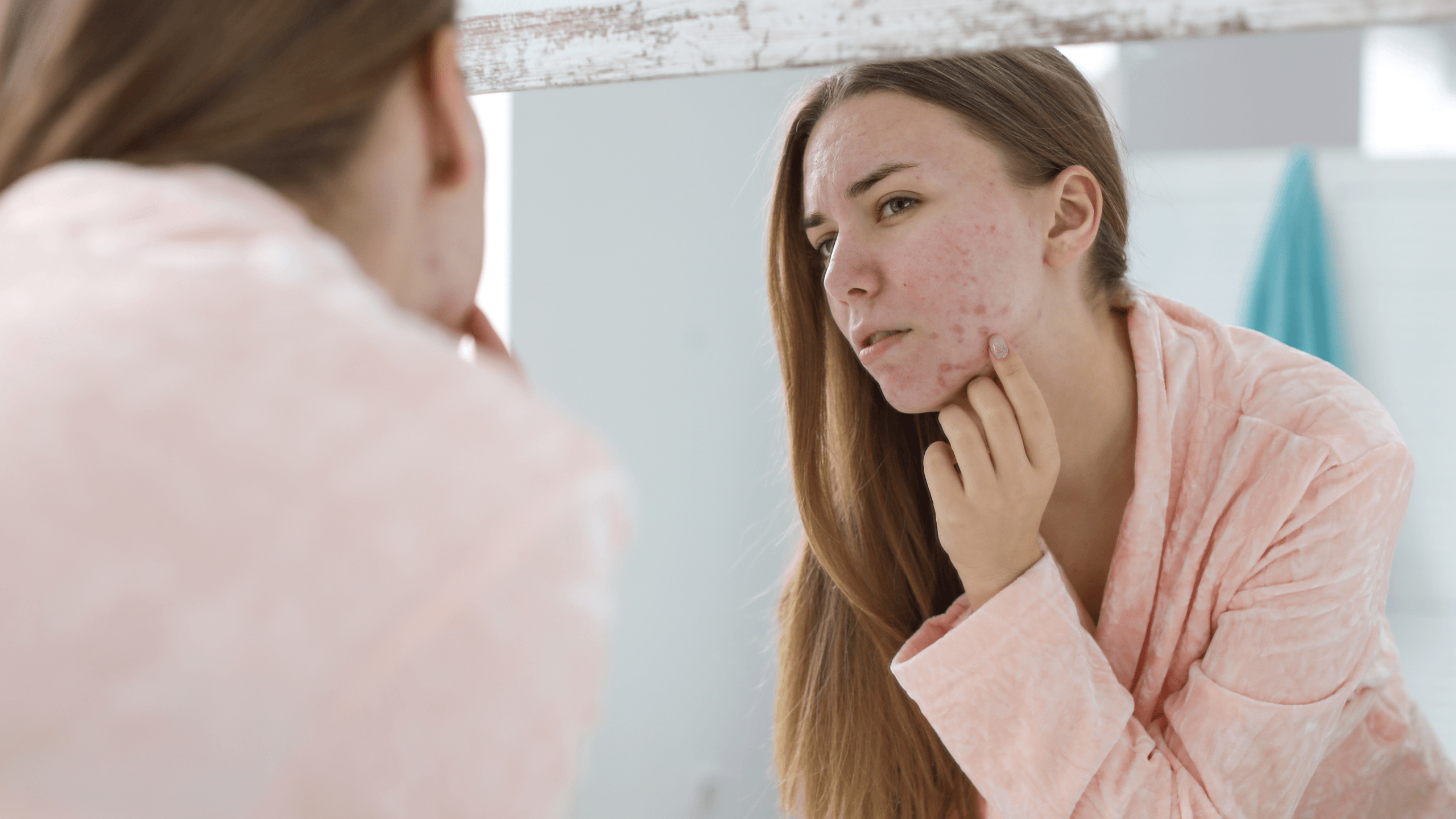 Rosacea vs. Acne - Gladskin