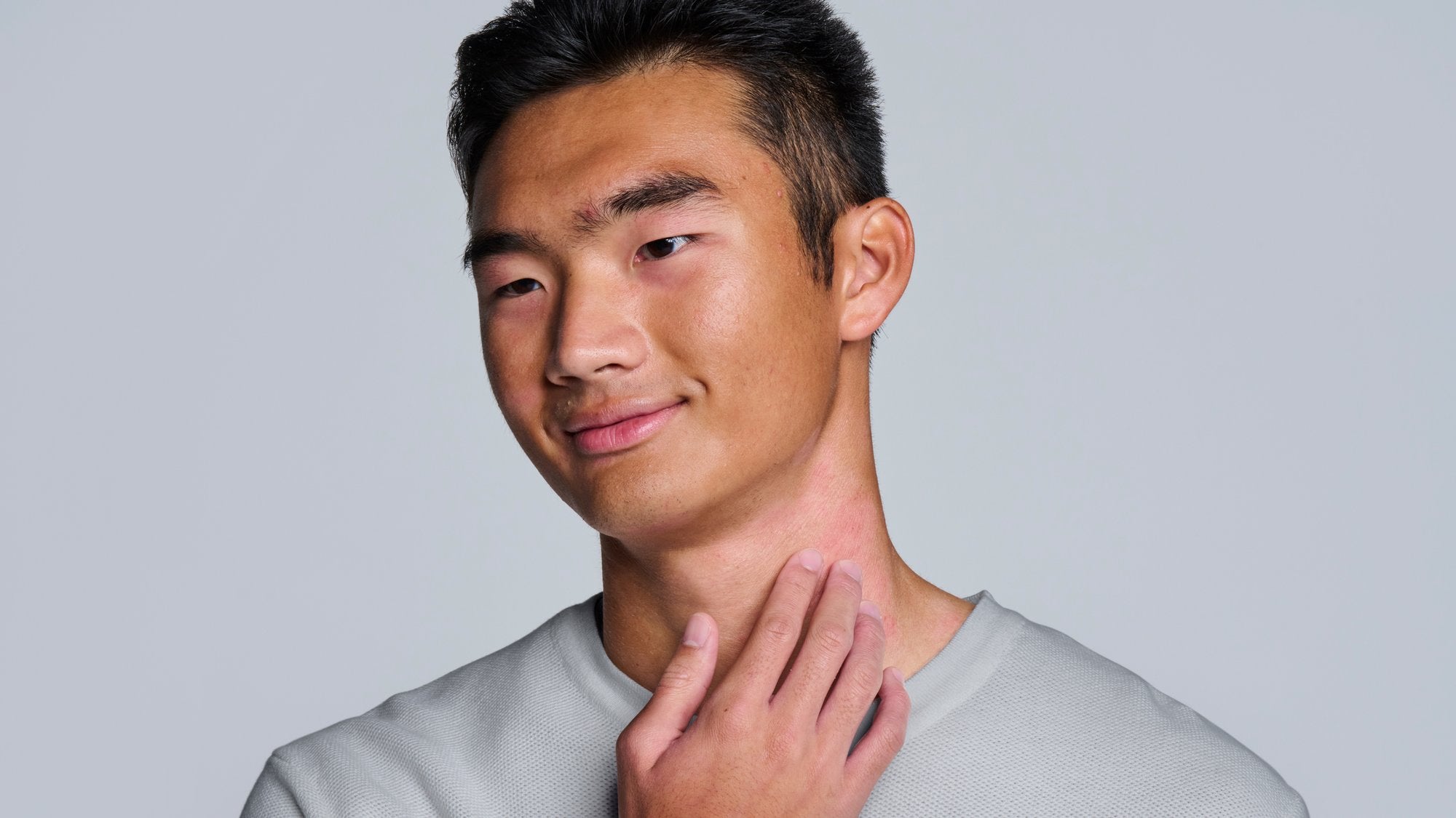 Eczema Hope with Jeremy Paredes - Gladskin