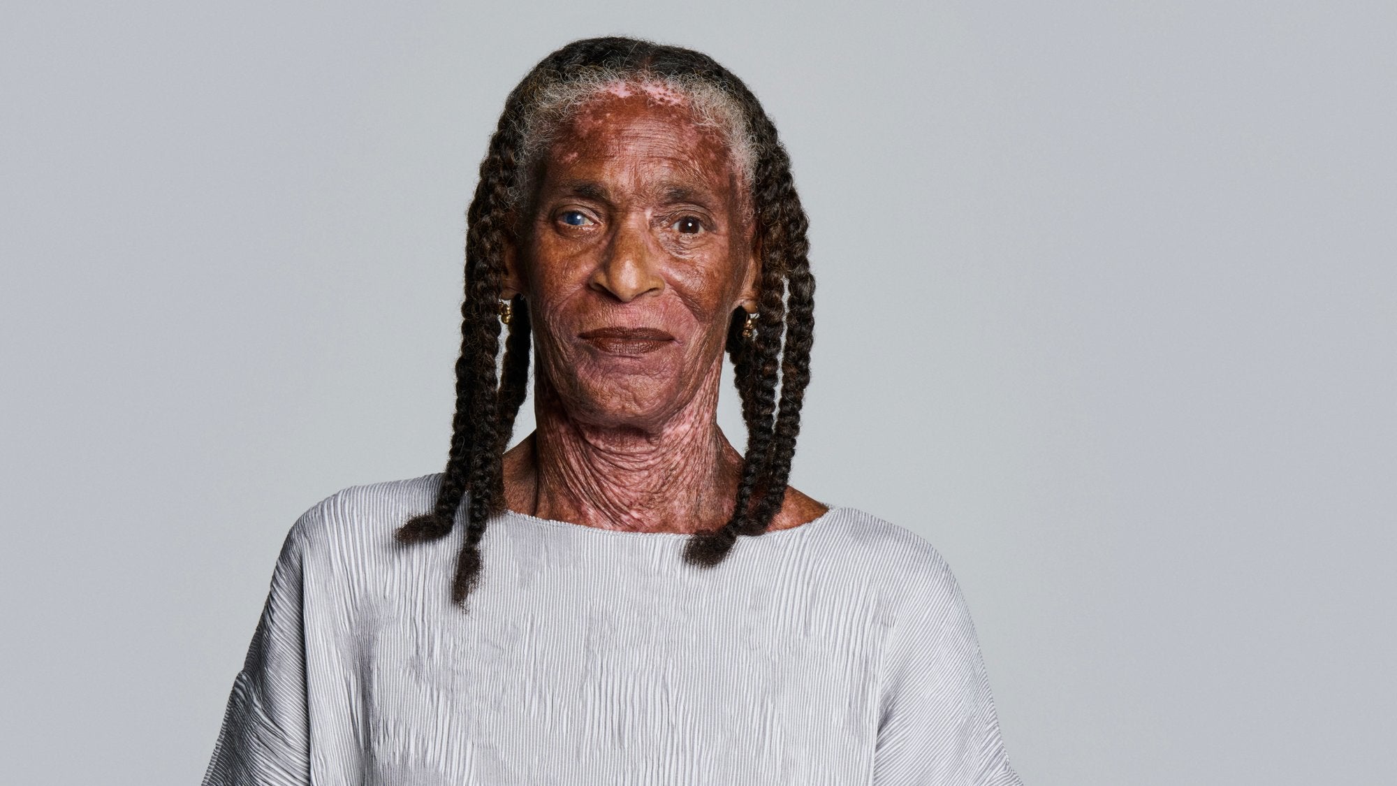 Eczema Resilience with Luverne Connelly - Gladskin