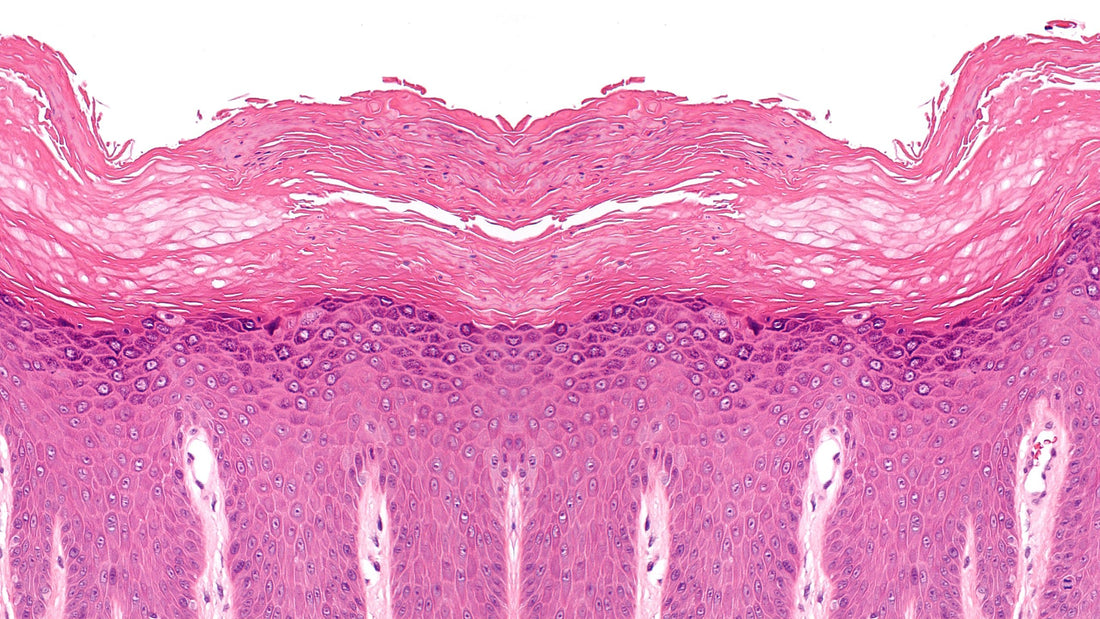 Types of Eczema: Neurodermatitis - Gladskin