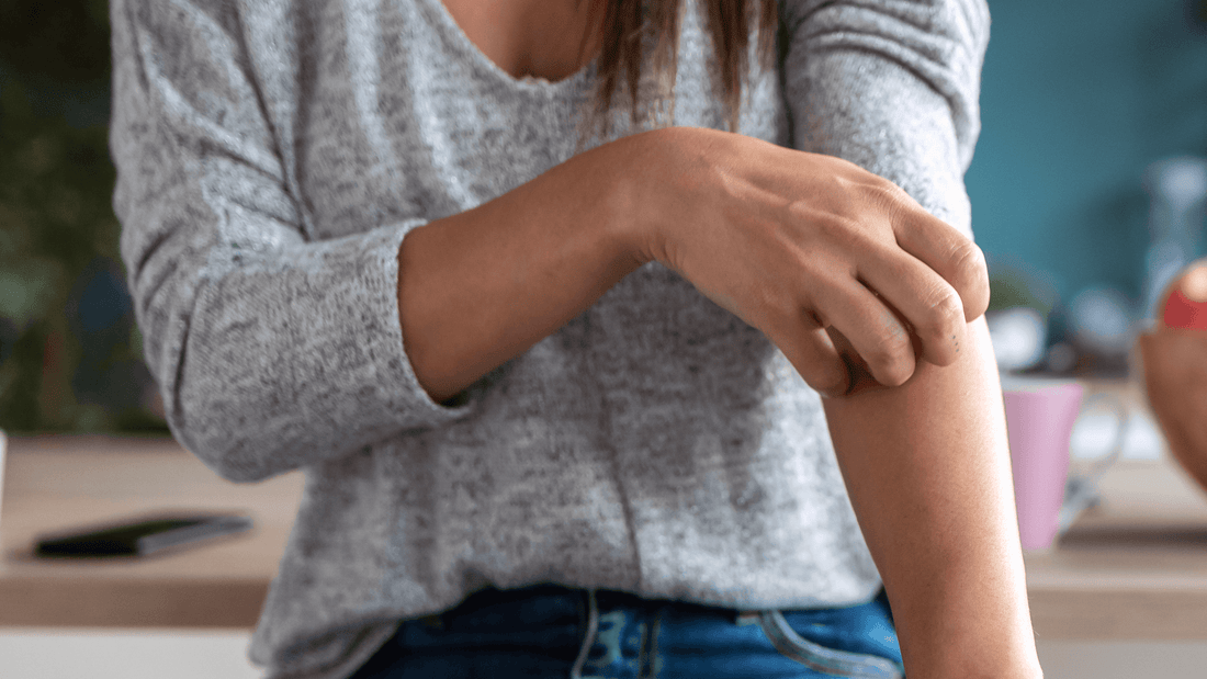 Eczema and Hormones: How Are They Related? - Gladskin