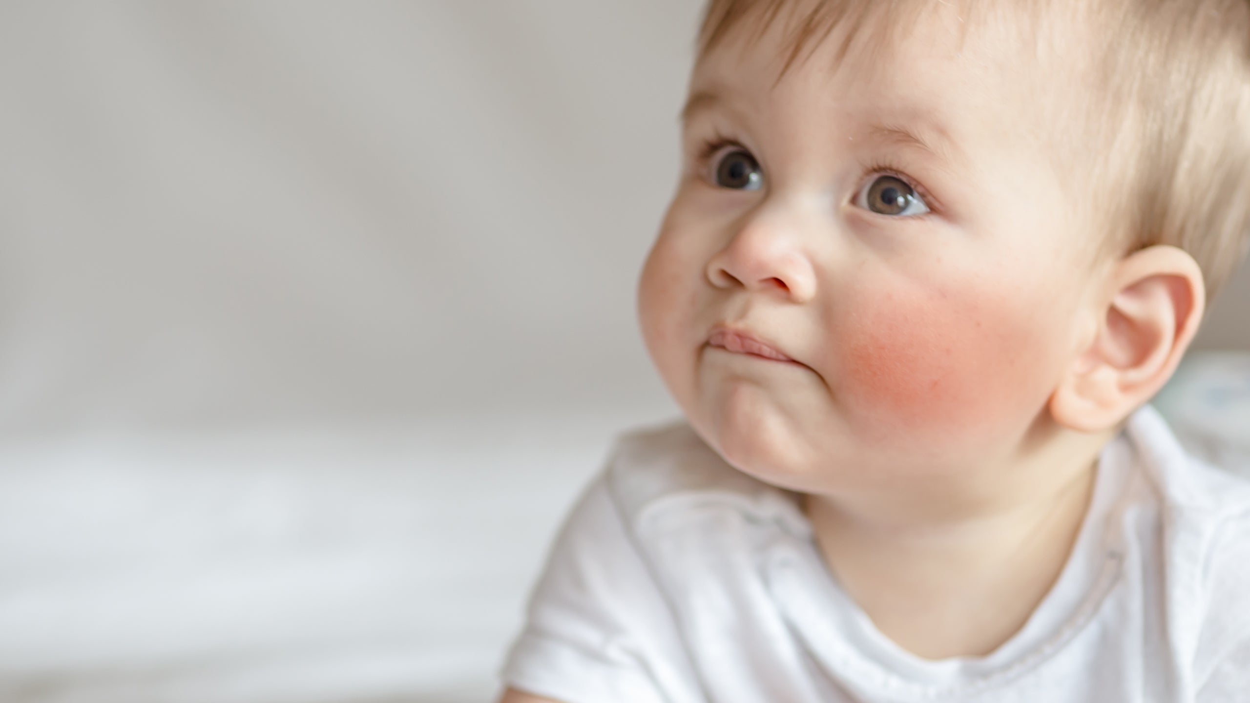 Baby Eczema vs. Acne: How to Tell the Difference - Gladskin