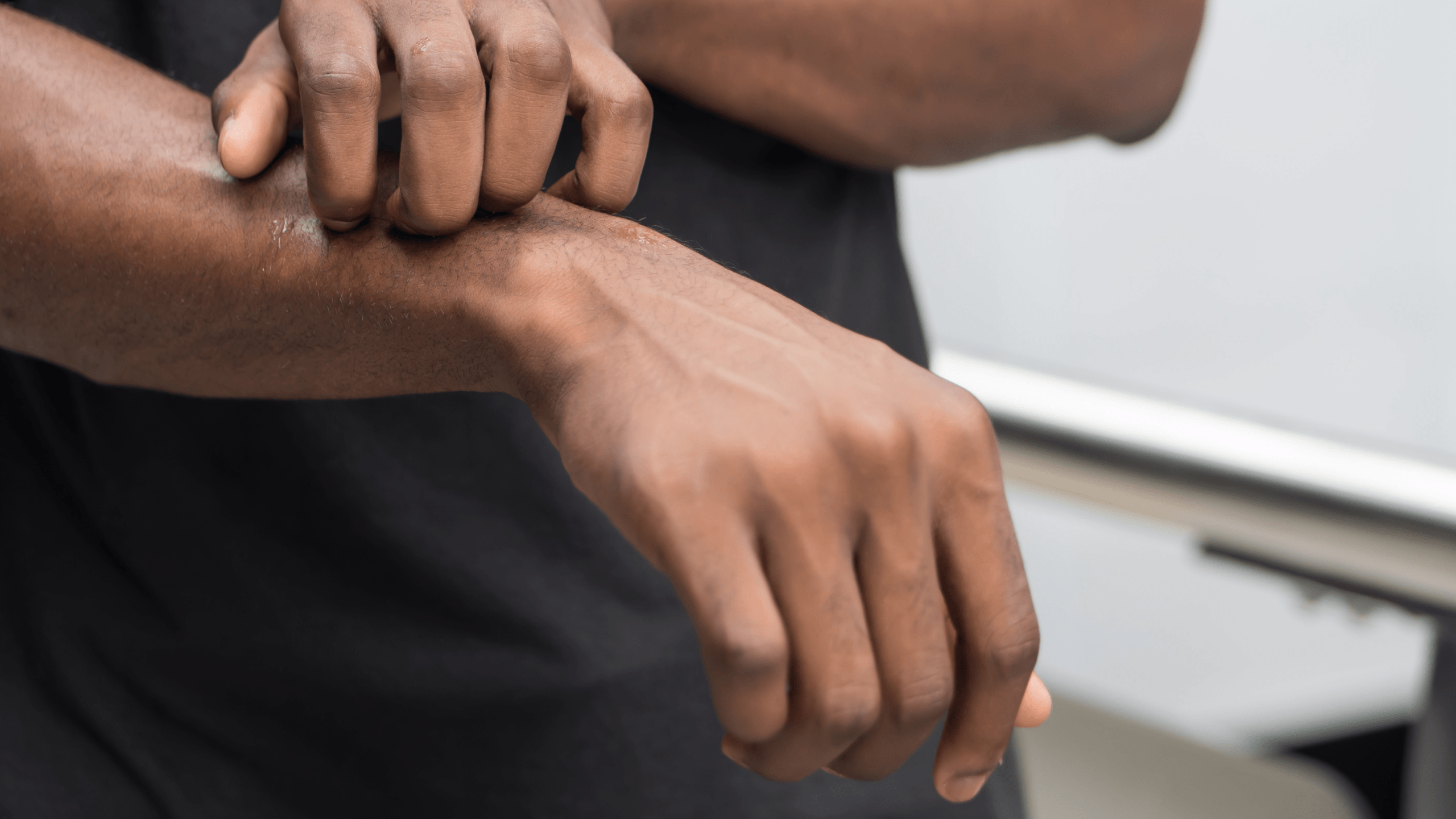 Mild vs. Severe Eczema: What's the Threshold and How, If at All, Does It Change Treatment? - Gladskin