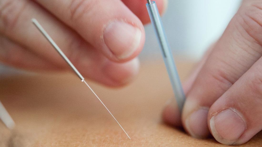 Traditional Chinese Medicine for Eczema: What You Need to Know - Gladskin