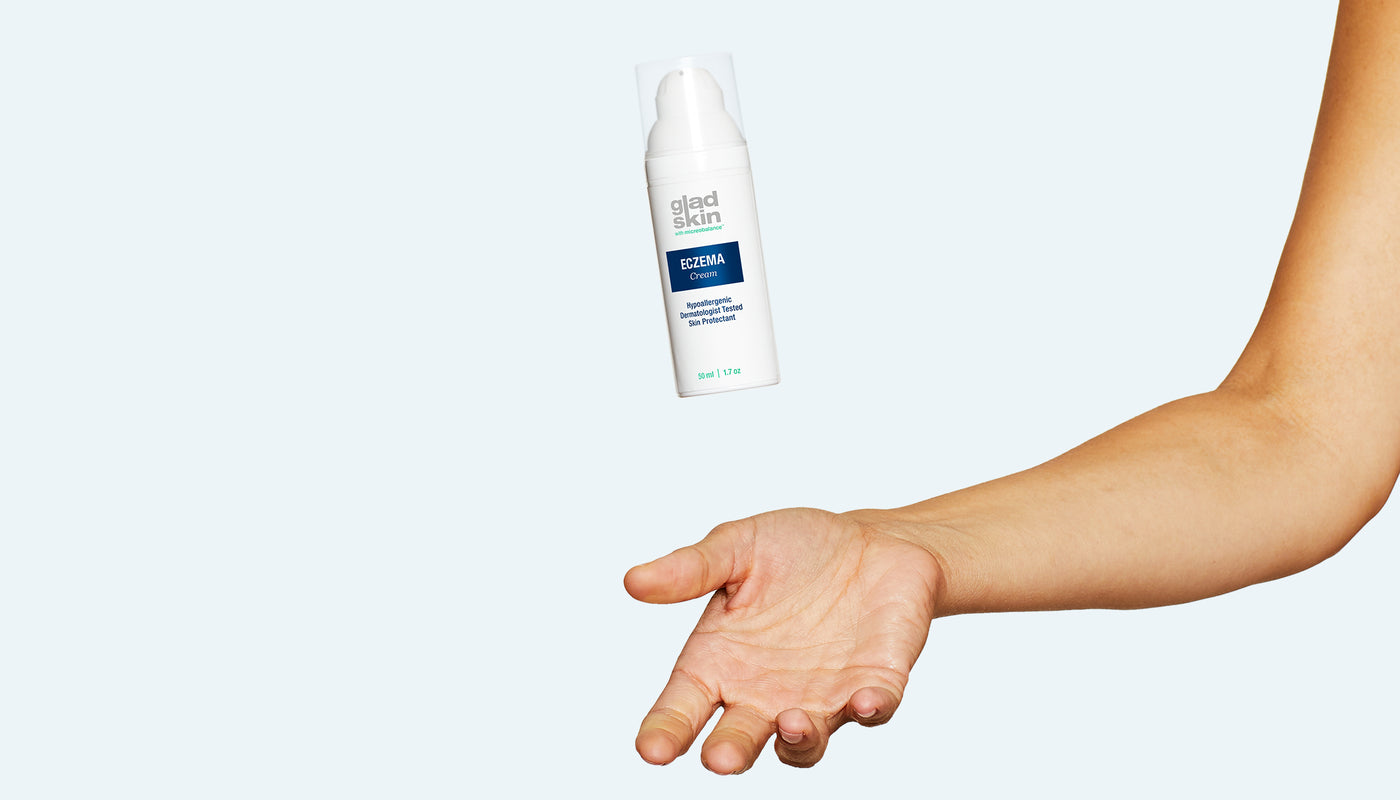 hand catching eczema cream product